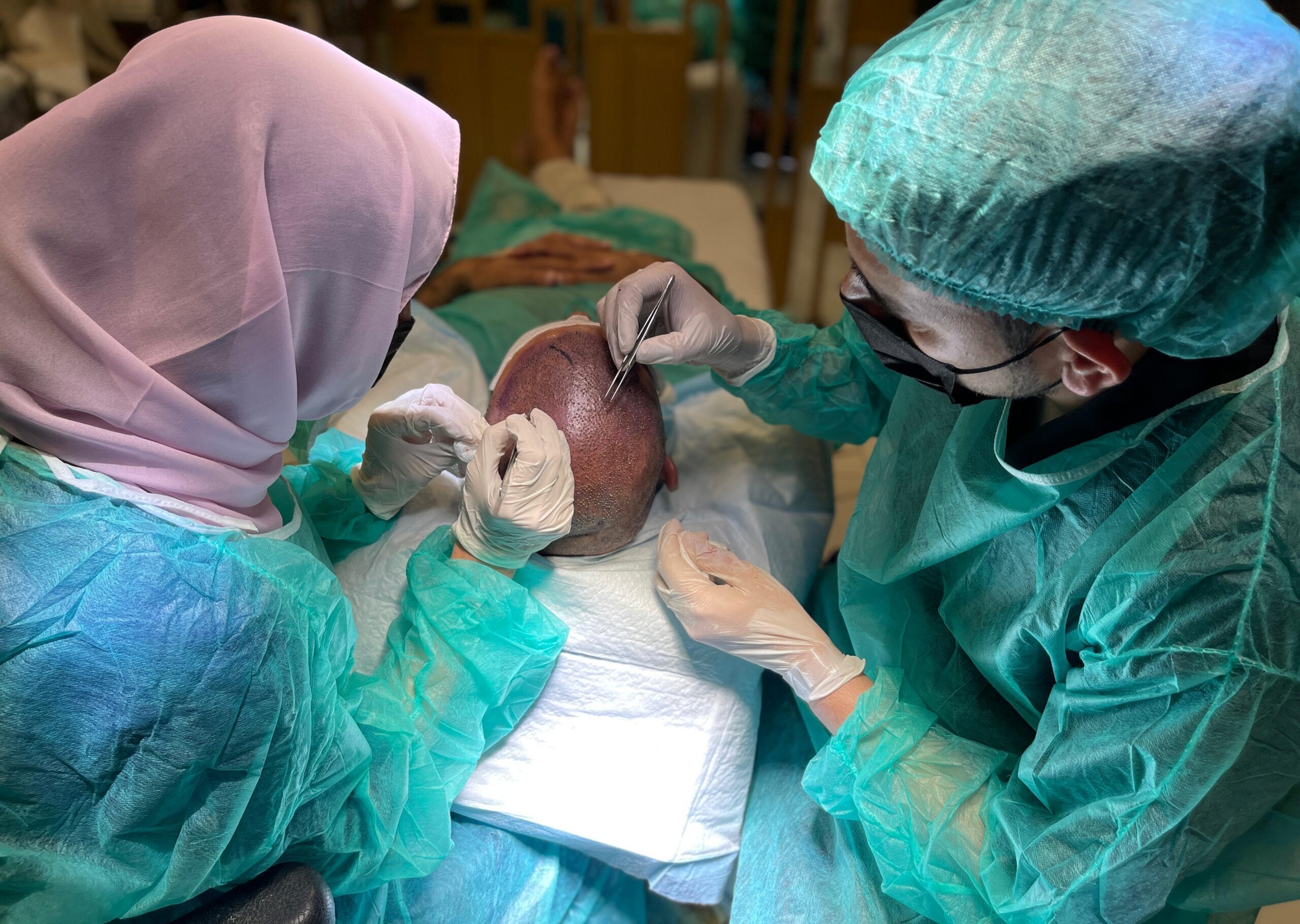 Female hair transplant patient at Estheticare Boutique Clinic Islamabad